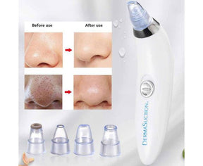 Electric Blackhead Remover