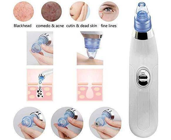 Electric Blackhead Remover