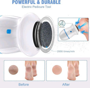 Electric Foot Callus Remover